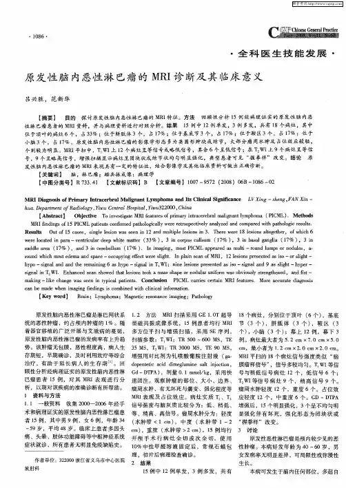 原发性脑内恶性淋巴瘤的MRI诊断及其临床意义