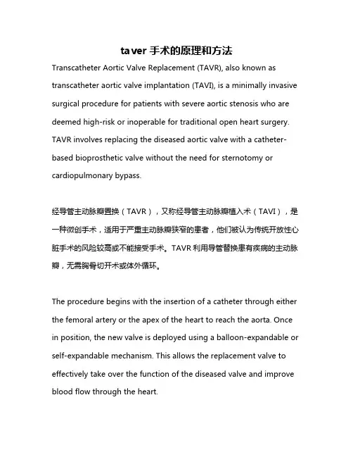 taver手术的原理和方法