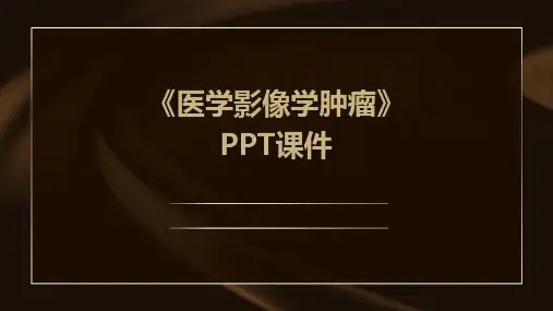 《医学影像学肿瘤》课件