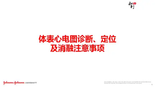 室早室速体表心电图定位