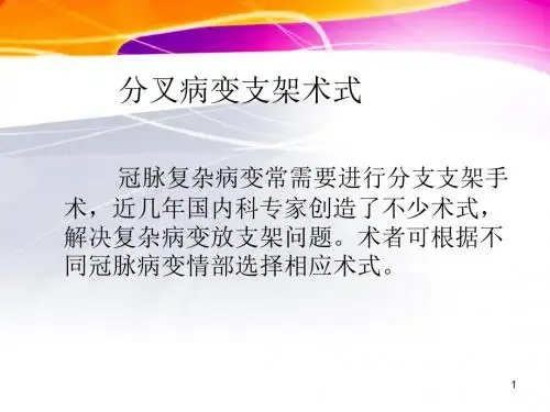 分叉支架PPT医学课件