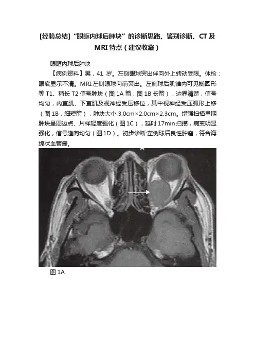 [经验总结]“眼眶内球后肿块”的诊断思路、鉴别诊断、CT及MRI特点（建议收藏）