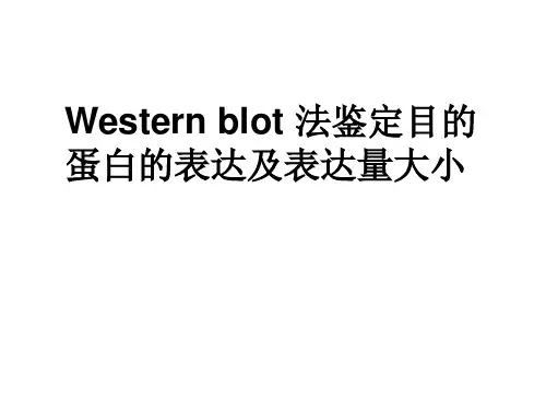 基础生物化学实验课件PPT-Western blot 法鉴定目的蛋白的表达及表达量大小