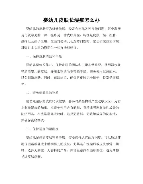 婴幼儿皮肤长湿疹怎么办