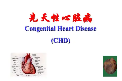 动脉导管未闭ppt课件