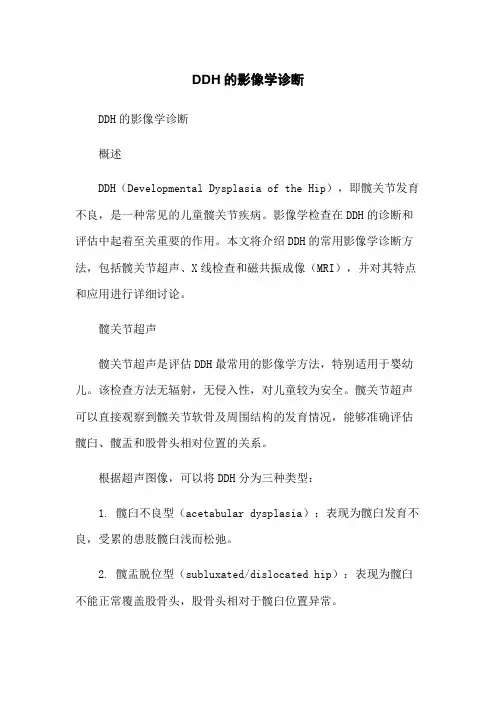DDH的影像学诊断