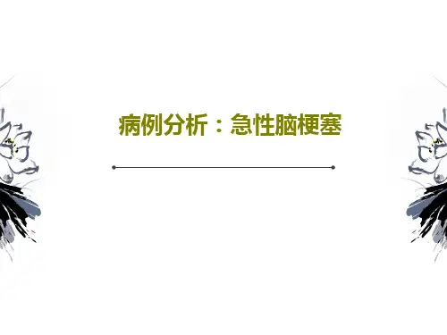 病例分析：急性脑梗塞共24页文档