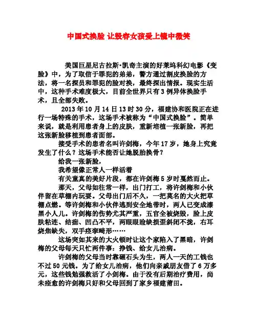 中国式换脸让毁容女孩爱上镜中微笑[权威资料]