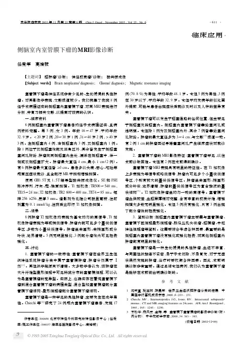 侧脑室内室管膜下瘤的MRI影像诊断