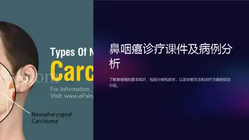 “鼻咽癌诊疗课件及病例分析”