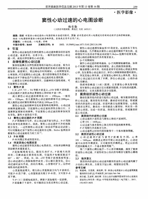 窦性心动过速的心电图诊断