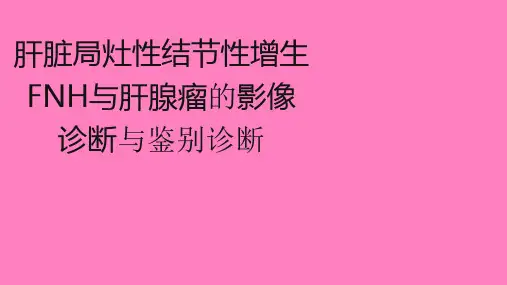 肝局灶性结节增生FNH和肝腺瘤的影像诊断与鉴别诊断