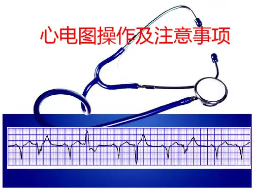 心电图检查操作及注意事项