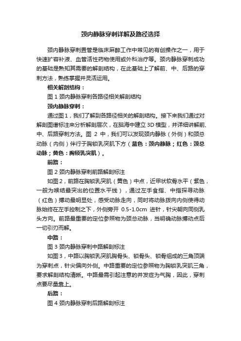 颈内静脉穿刺详解及路径选择