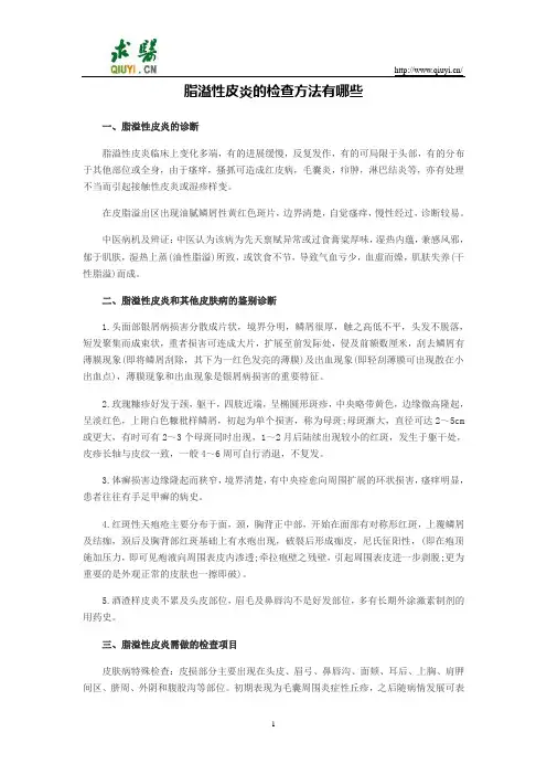 脂溢性皮炎的检查方法有哪些