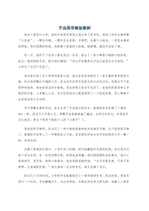 牙齿美学修复案例