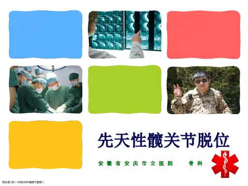 先天性髋关节脱位(王栋)