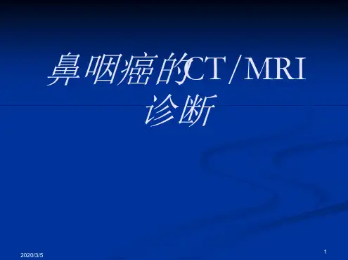 鼻咽癌的CT与MRI诊断最新优质PPT课件