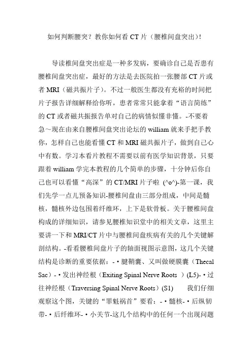如何判断腰突？教你如何看CT片(腰椎间盘突出)!.doc