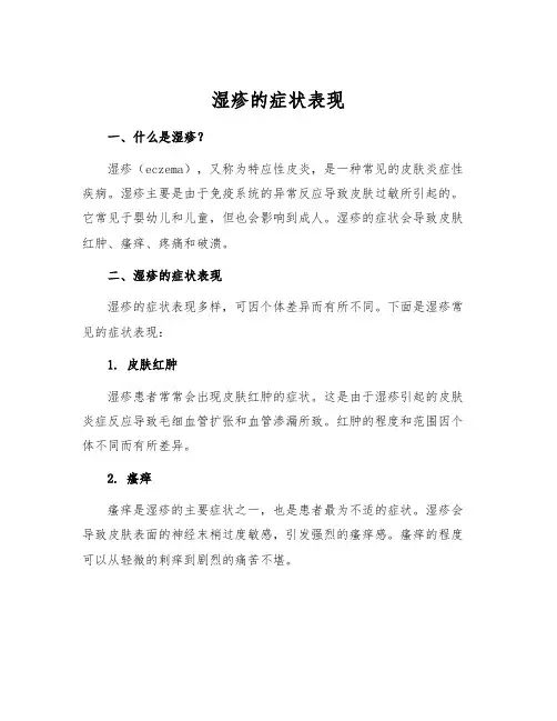 湿疹的症状表现