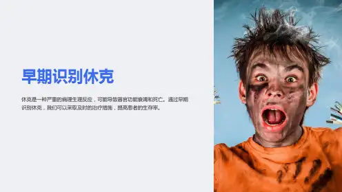 《休克的早期识别》课件