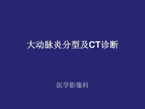 大动脉炎分型及CT诊断
