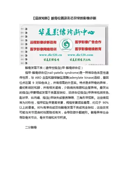 【温故知新】髌骨位置及形态异常的影像诊断