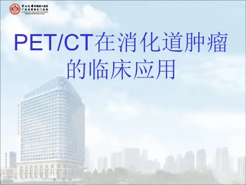 PETCT在消化道肿瘤的临床应用-优秀医学PPT课件