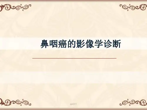 鼻咽癌的MRI影像学诊断  ppt课件
