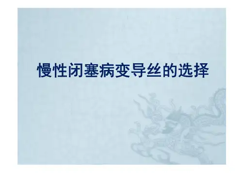 CTO导丝选择