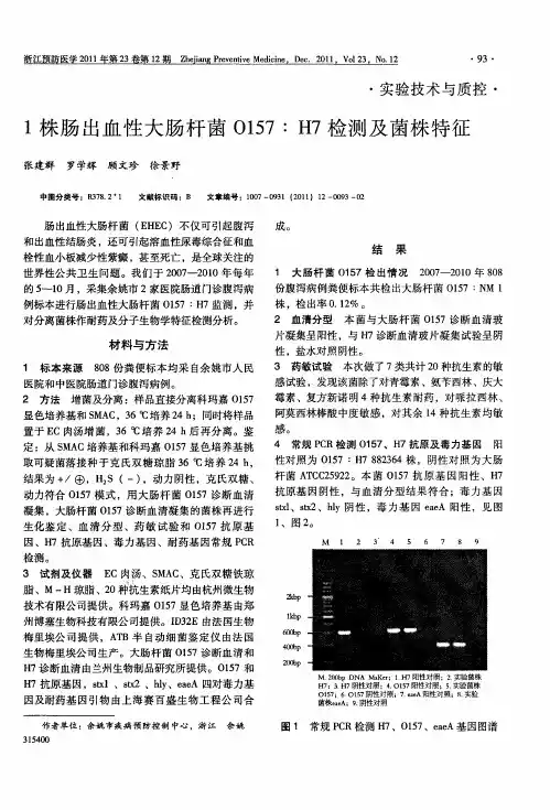 1株肠出血性大肠杆菌O157：H7检测及菌株特征