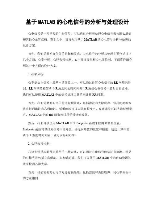 基于MATLAB的心电信号的分析与处理设计