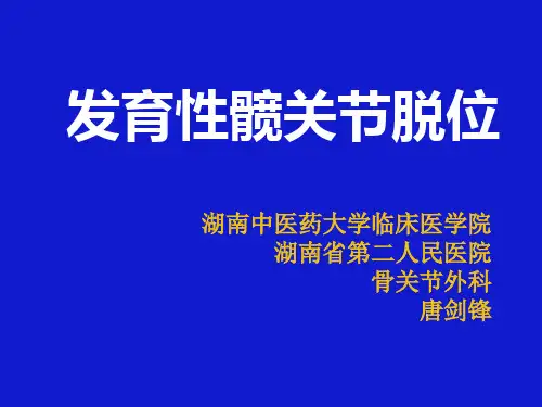 发育性髋关节脱位--gai