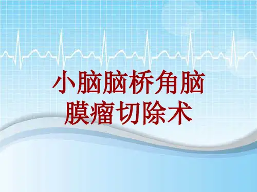 手术讲解模板：小脑脑桥角脑膜瘤切除术