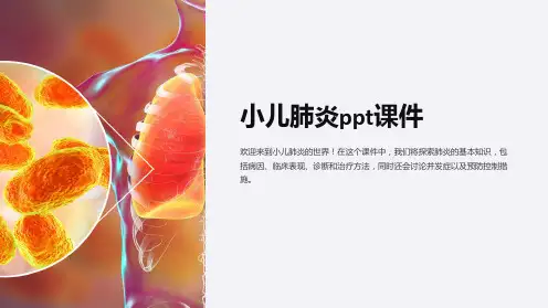 小儿肺炎ppt课件