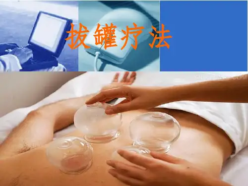 拔罐疗法ppt课件