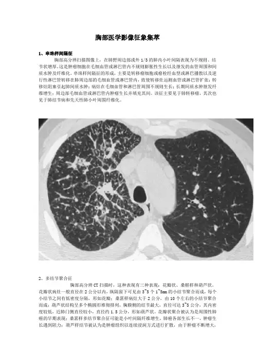 全面的胸部医学影像征象