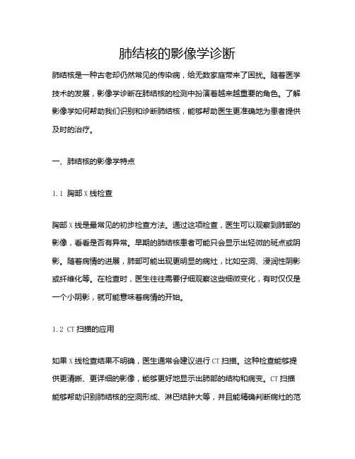 肺结核的影像学诊断