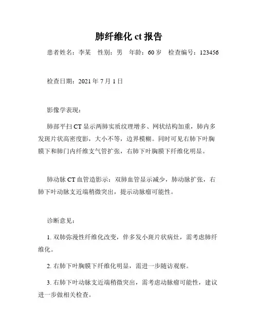 肺纤维化ct报告