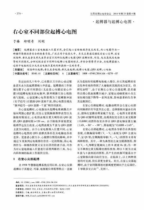 右心室不同部位起搏心电图