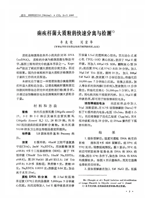 痢疾杆菌大质粒的快速分离与检测1)