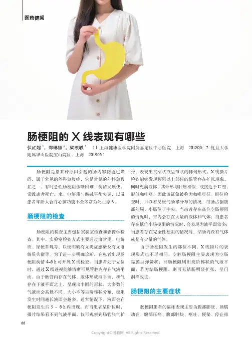 肠梗阻的X线表现有哪些