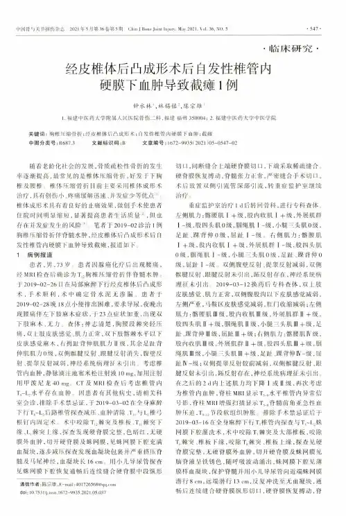 经皮椎体后凸成形术后自发性椎管内硬膜下血肿导致截瘫1例
