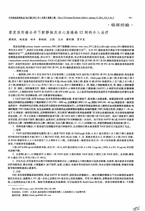 原发性肝癌合并下腔静脉及右心房癌栓12例的介入治疗