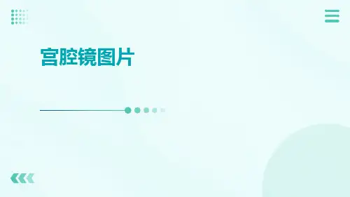 (医学课件)宫腔镜图片