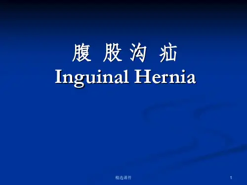 腹股沟疝讲课比赛课件