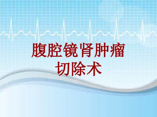 手术讲解模板：腹腔镜肾肿瘤切除术