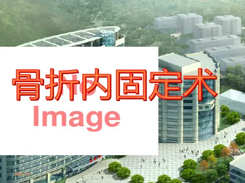 骨折内固定术PPT课件