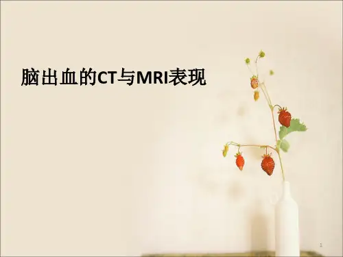 脑出血的影像学表现PPT参考幻灯片
