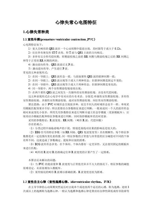 心律失常心电图特征